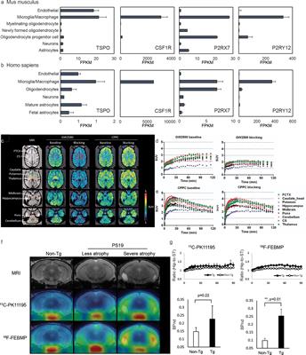 PET Imaging of Neuroinflammation in Alzheimer’s Disease